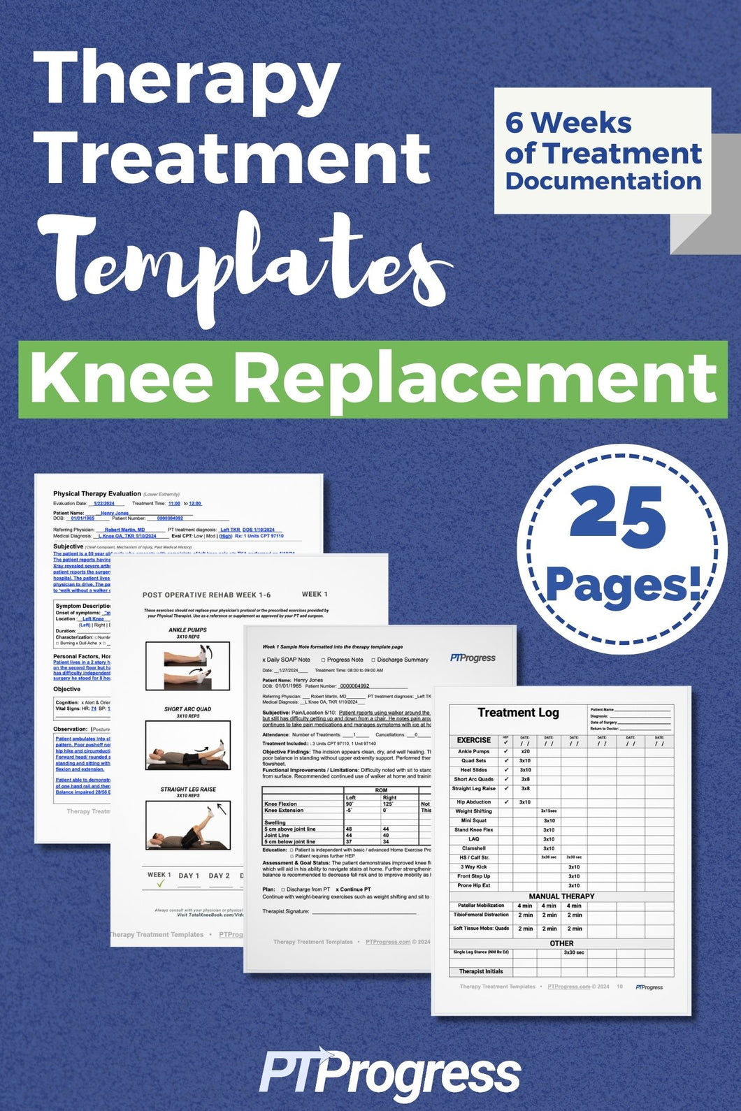 Therapy Treatment Templates Total Knee Replacement